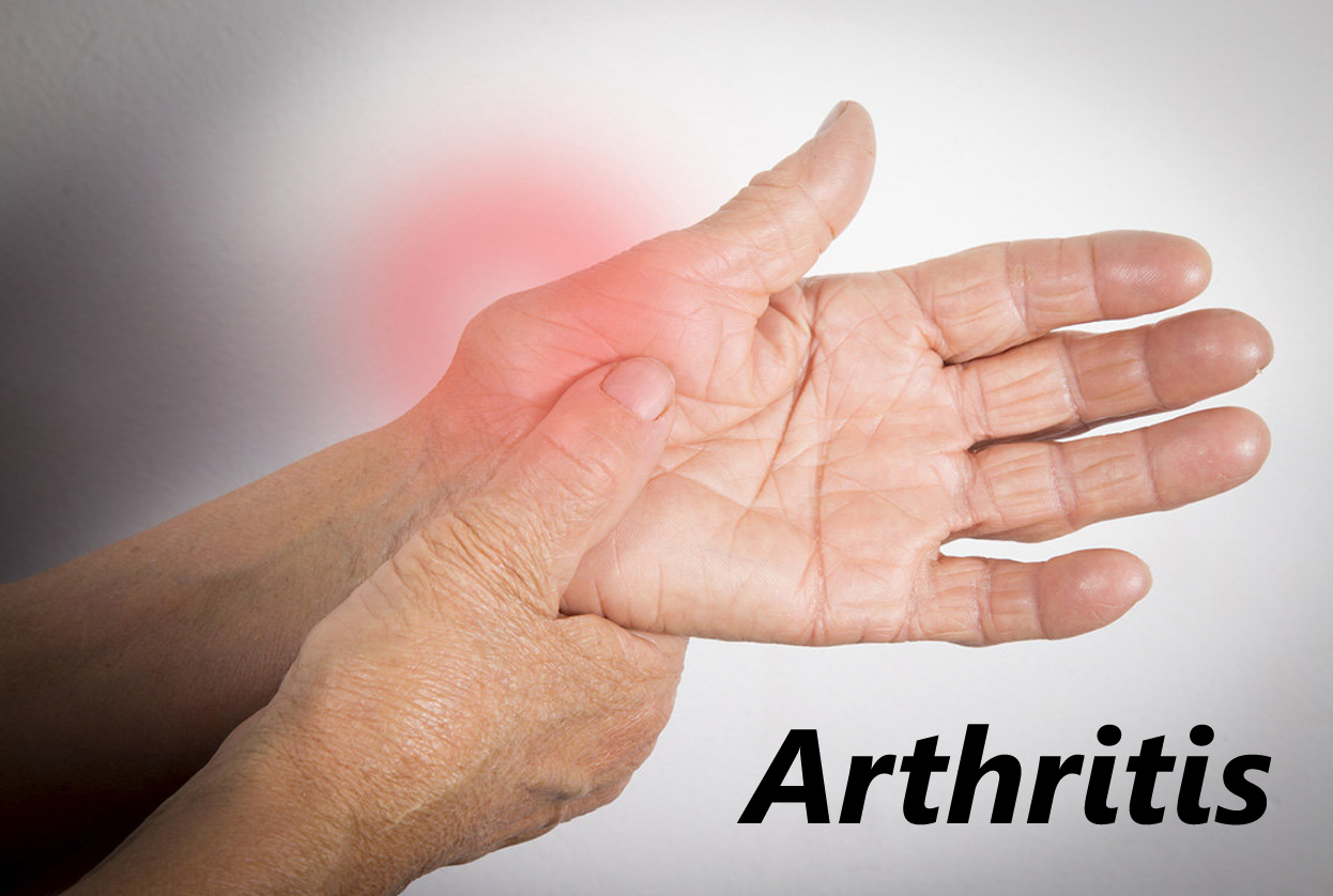 Arthritis and Posture Care