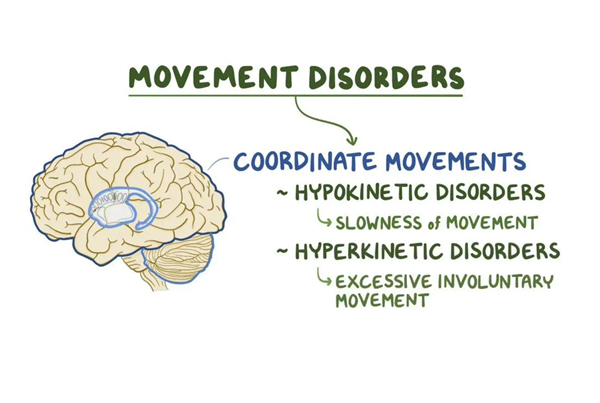 ConstraintInduced Movement Therapy