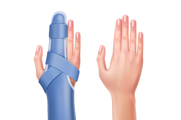 Splinting and Functional Adaptation